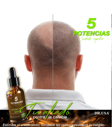 Serum 5 Potencias Anticaída | Cabello Más Fuerte y Abundante
